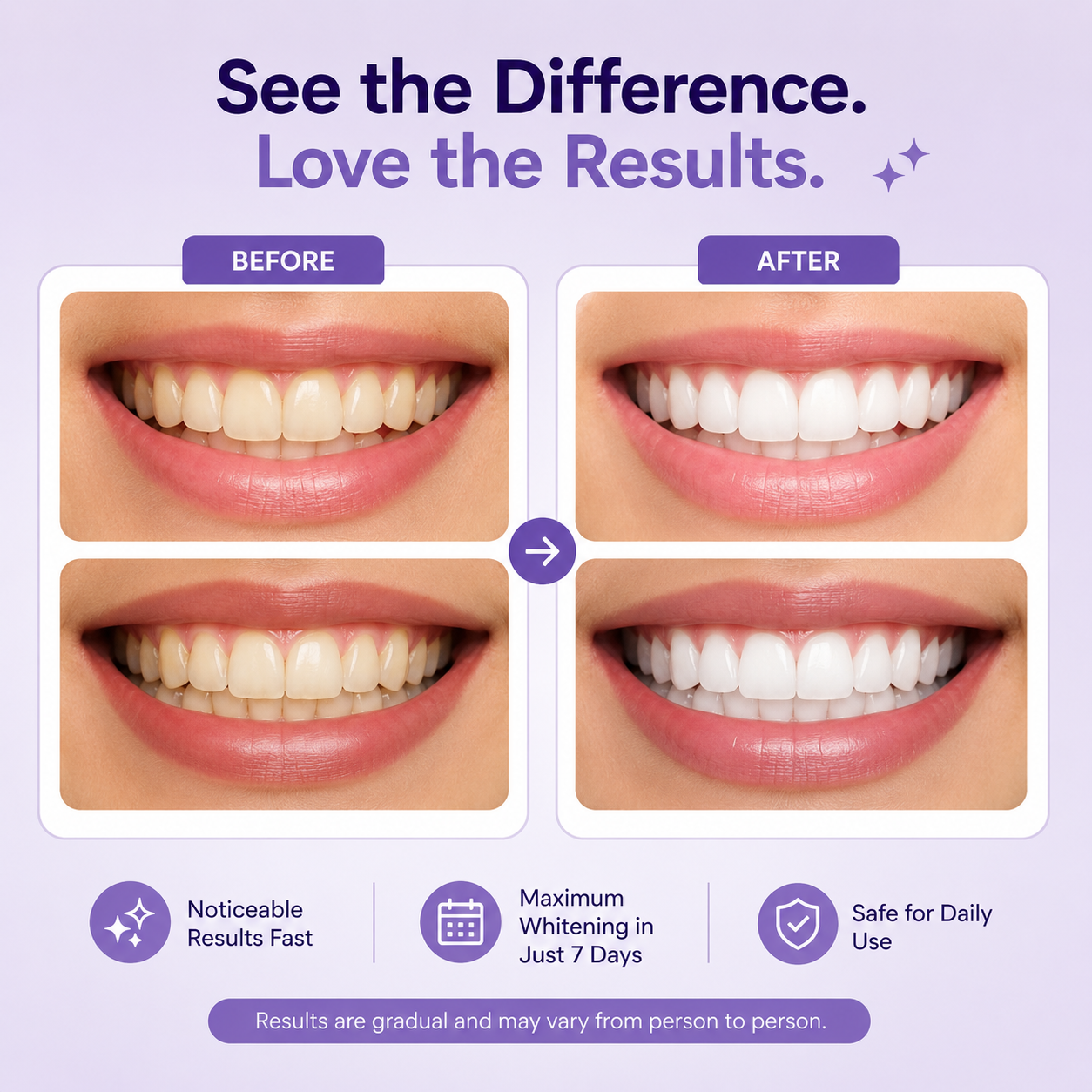 Purple Whitening Strips